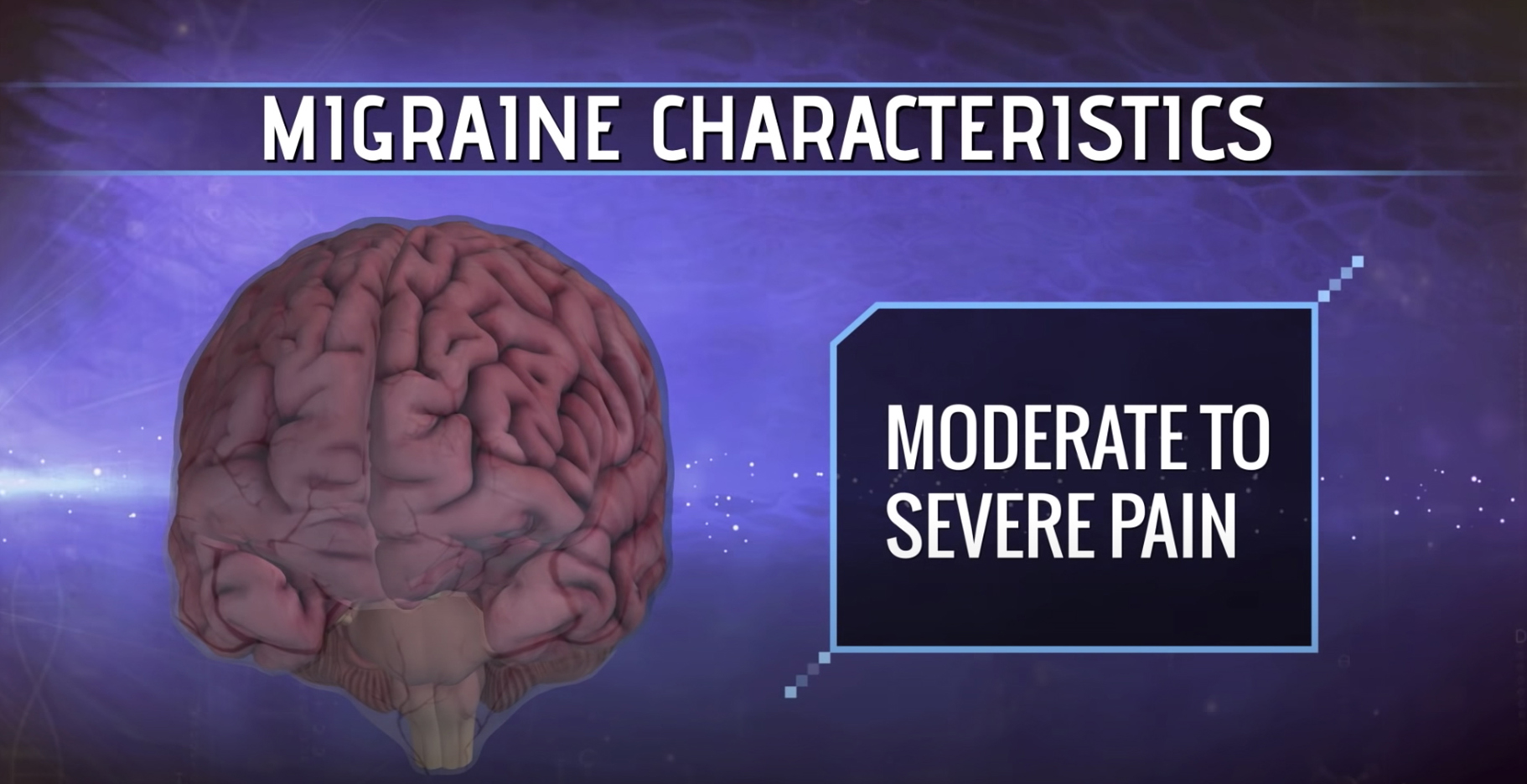 The Science of Migraines