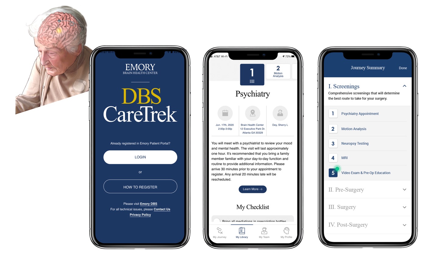 DBS CareTrak app as viewed on an mobile device. Illustration of a deep brain stimulation electrode inserted into a person's brain.