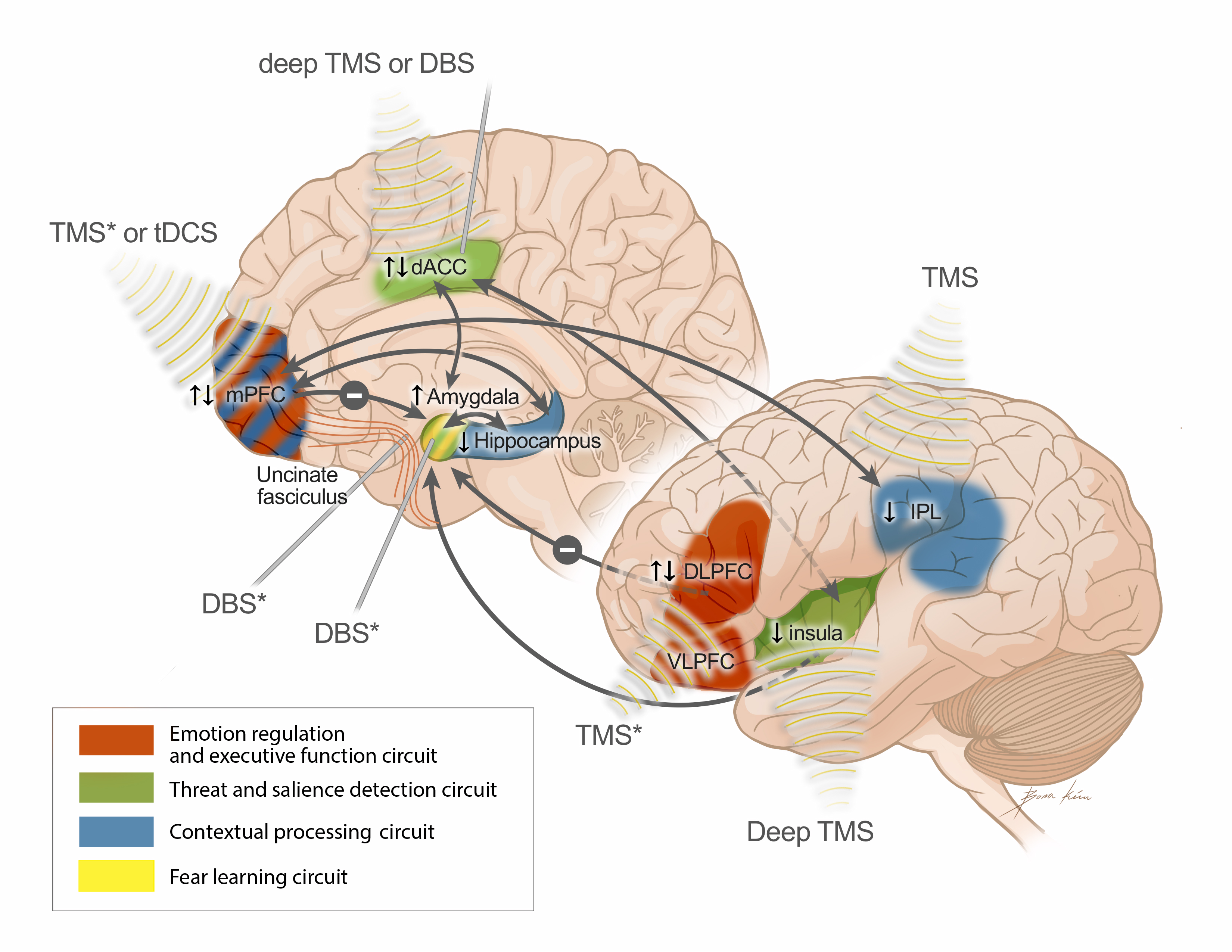 PTSD Treatment response