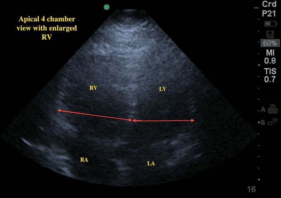 apical