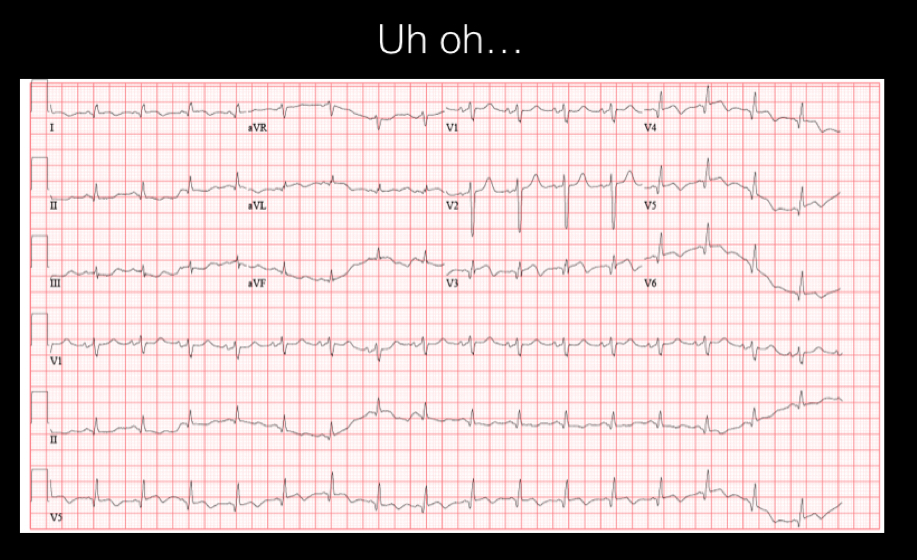 ekg2