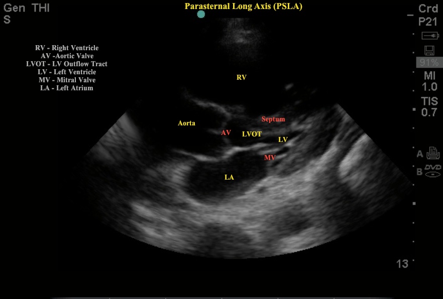 PLSA IOW labeled