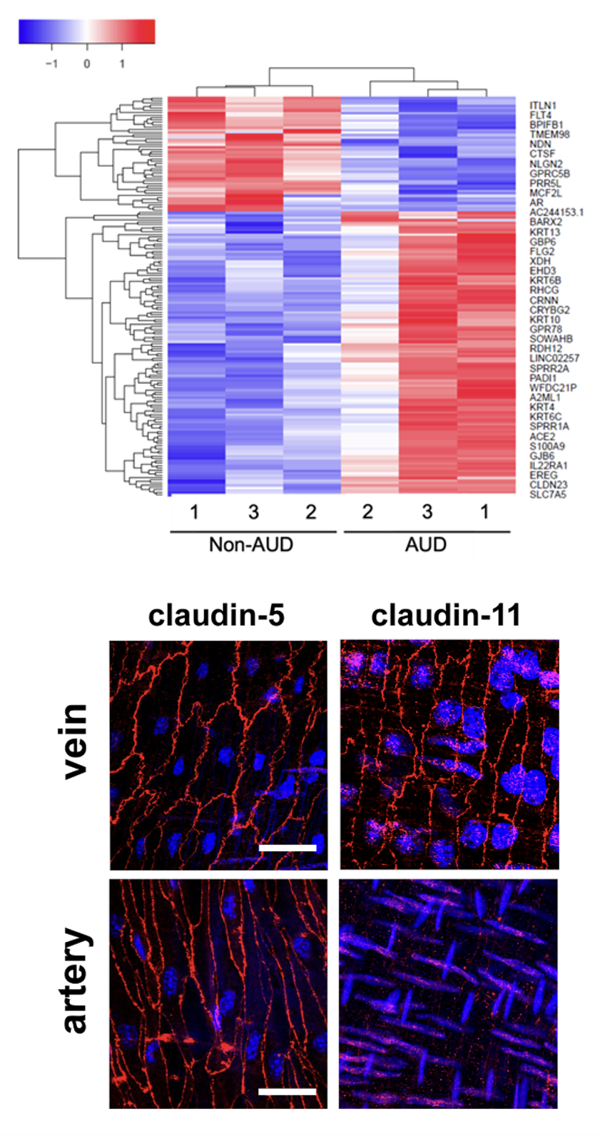 Purinergic Regulation of Veinous Endothelial Permeability