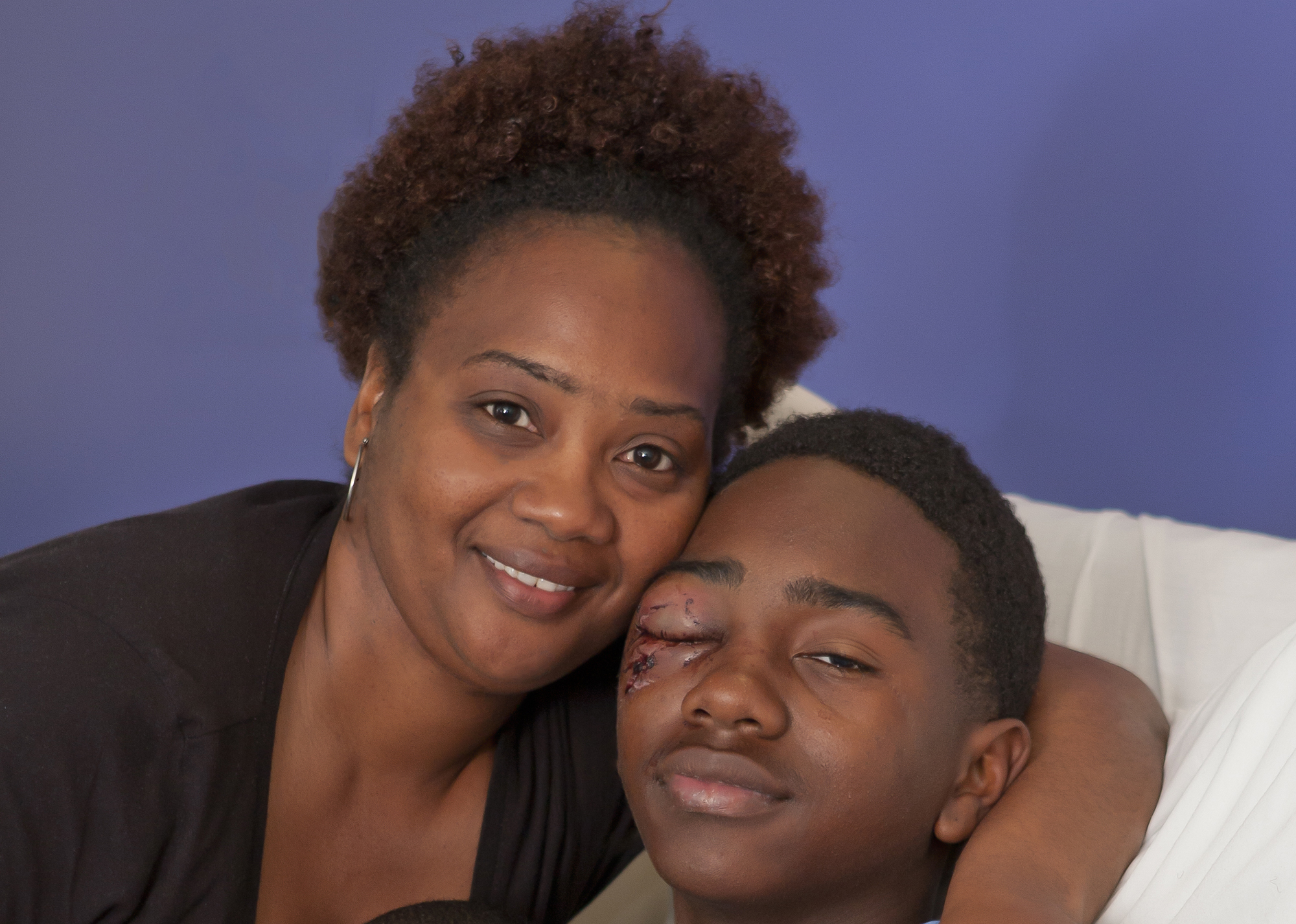 mother with her son who has suffered a physical injury to his eye