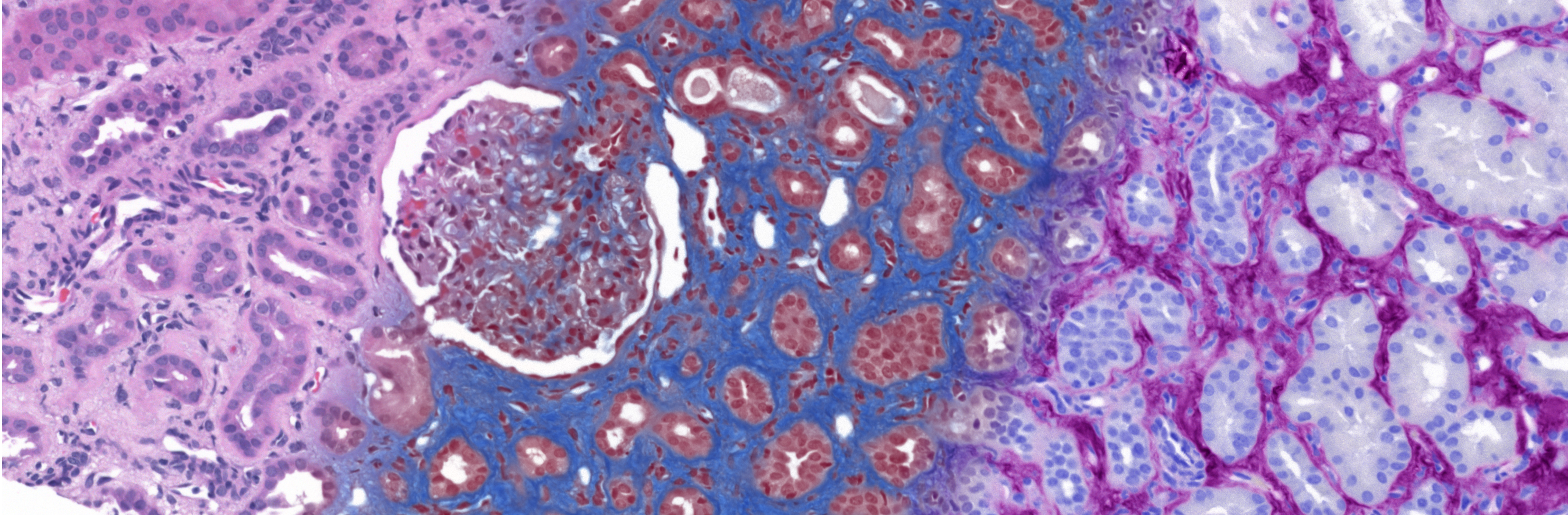Duet Kidney Banner