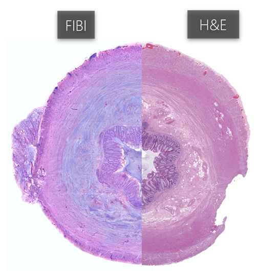 Comparison of the appendix with FIBI imaging (left) and traditional FFPE H&E (right).