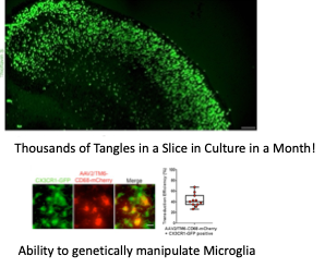 Neurodegenerative Disease