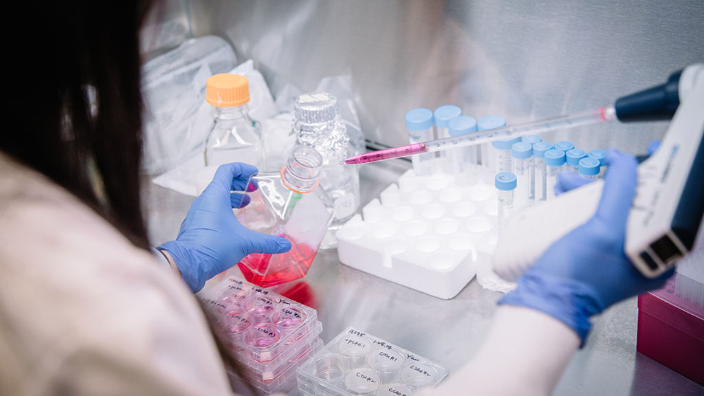 Cancer researcher in the lab using a pipette.