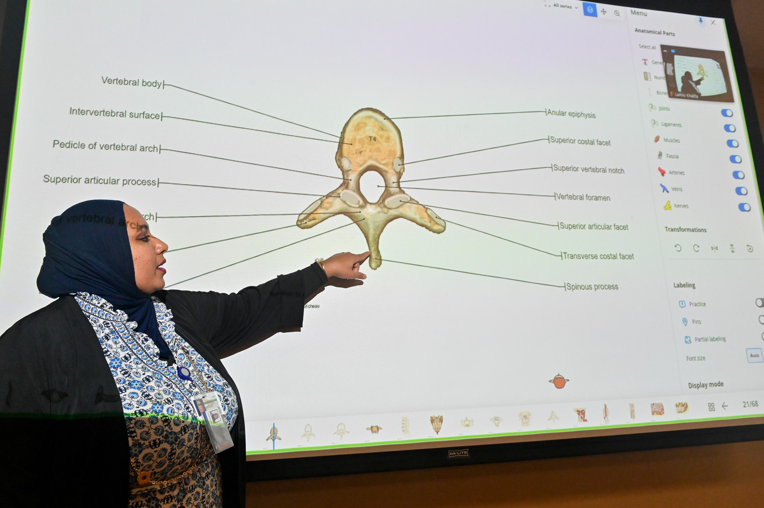 person standing in front of white board pointing to parts of a bone in an illustration