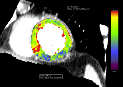  showing dynamic ct perfusion imaging