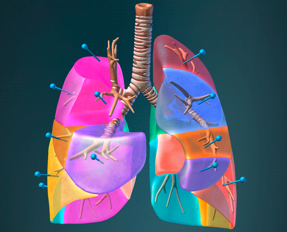medical illustration.